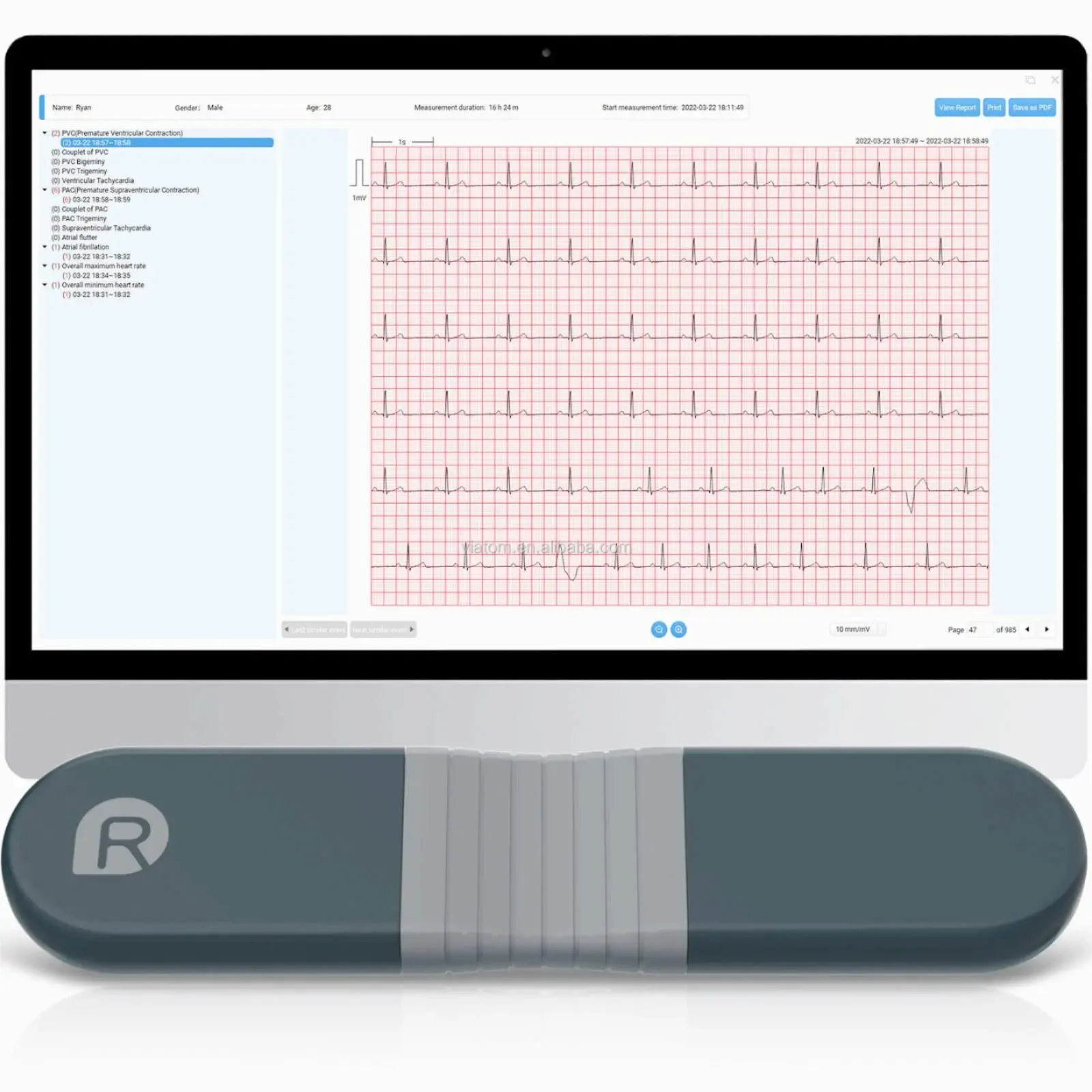 Draadloze Bluetooth dynamische - Ecg Patch Monitor recensie en prijs